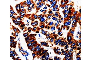 Immunohistochemistry (IHC) image for anti-Urotensin 2 (UTS2) antibody (ABIN2420948) (Urotensin 2 抗体)