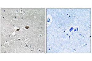 Immunohistochemistry analysis of paraffin-embedded human brain tissue, using TIGD3 antibody. (TIGD3 抗体  (C-Term))