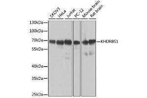Western blot analysis of extracts of various cell lines, using KHDRBS1 antibody. (KHDRBS1 抗体  (C-Term))
