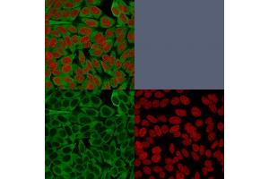 Confocal immunofluorescence image of HeLa cells using Fascin-1 Mouse Monoclonal Antibody (FSCN1/416). (Fascin 抗体)