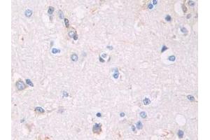 Immunohistochemistry (IHC) image for anti-CAP, Adenylate Cyclase-Associated Protein 1 (CAP1) (AA 33-218) antibody (ABIN7436249)