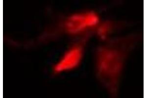 Immunofluorescence (fixed cells) (IF/ICC) image for anti-Solute Carrier Family 6 (Neurotransmitter Transporter, GABA), Member 11 (SLC6A11) (Internal Region) antibody (ABIN6265140)
