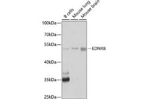 Western blot analysis of extracts of various cell lines, using EDNRB antibody (ABIN3016961, ABIN3016962, ABIN1679650 and ABIN6219903) at 1:1000 dilution. (EDNRB 抗体  (AA 1-100))