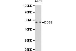 Western blot analysis of extracts of A-431 cells, using DDB2 antibody (ABIN5970947) at 1/1000 dilution. (DDB2 抗体)