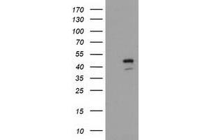 Image no. 1 for anti-serpin Peptidase Inhibitor, Clade B (Ovalbumin), Member 4 (SERPINB4) antibody (ABIN1500891)