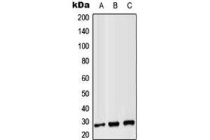 Western blot analysis of CD8b expression in Jurkat (A), Raw264. (CD8B 抗体  (Center))