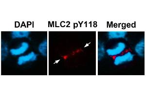 Immunofluorescence staining of methanol-fixed U87 cells using MLC2 (Phospho-Tyr118) Antibody. (MYL9 抗体  (pTyr118))
