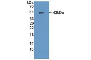 Detection of Recombinant MIP3b, Mouse using Polyclonal Antibody to Macrophage Inflammatory Protein 3 Beta (MIP3b) (CCL19 抗体  (AA 22-107))