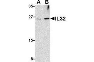 Western blot analysis of IL-32 in Jurkat cell lysate with AP30425PU-N IL-32 antibody at (A) 2. (IL32 抗体  (Intermediate Domain))