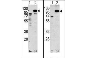 (LEFT)Western blot analysis of APP (arrow) using rabbit polyclonal APP Antibody (N-term). (APP 抗体  (C-Term))