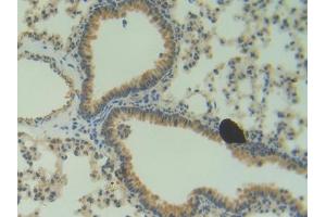 DAB staining on IHC-P; Samples: Mouse Lung Tissue (ANG 抗体  (AA 25-145))