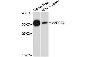 Western blot analysis of extracts of various cell lines, using MAPRE3 antibody. (MAPRE3 抗体)