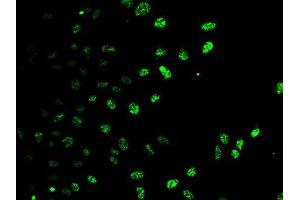 Immunofluorescence analysis of U2OS cells using E2F6 antibody. (E2F6 抗体)