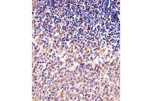 Immunohistochemical analysis of paraffin-embedded M. (Cyclin B1 抗体  (AA 103-130))