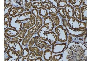 ABIN6278976 at 1/100 staining Rat kidney tissue by IHC-P. (ACAA2 抗体  (Internal Region))