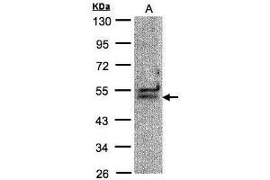 WB Image Sample(30 μg of whole cell lysate) A:Hep G2, 10% SDS PAGE antibody diluted at 1:1000 (DDX39B 抗体)