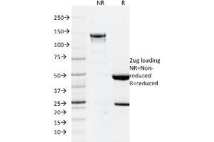 SDS-PAGE Analysis Purified GFAP Mouse Monoclonal Antibody (GFAP/2076). (GFAP 抗体  (AA 101-200))