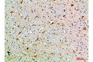 Immunohistochemical analysis of paraffin-embedded human-brain, antibody was diluted at 1:200 (SEMA7A 抗体  (AA 101-150))