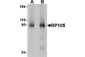 Western Blotting (WB) image for anti-CD180 Molecule (CD180) (C-Term) antibody (ABIN1030626) (CD180 抗体  (C-Term))