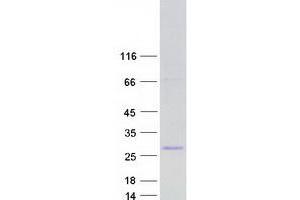 Western Blotting (WB) image for OCIA Domain Containing 1 (OCIAD1) (Transcript Variant 5) protein (Myc-DYKDDDDK Tag) (ABIN2727865)