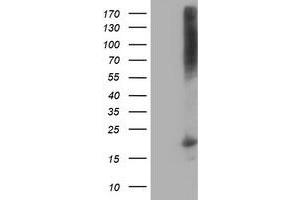 Western Blotting (WB) image for anti-Destrin (Actin Depolymerizing Factor) (DSTN) antibody (ABIN1497911) (Destrin 抗体)