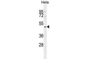 SMYD1 Antibody (C-term) western blot analysis in Hela cell line lysates (35µg/lane). (SMYD1 抗体  (C-Term))