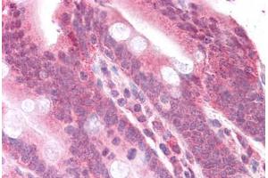 Human Small Intestine: Formalin-Fixed, Paraffin-Embedded (FFPE)