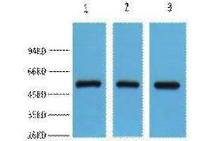 Western Blotting (WB) image for anti-Fumarate Hydratase (FH) antibody (ABIN3181264) (FH 抗体)