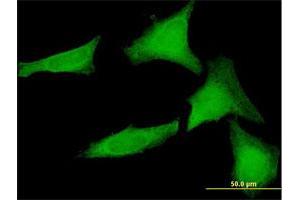 Immunofluorescence of purified MaxPab antibody to SGTA on HeLa cell.