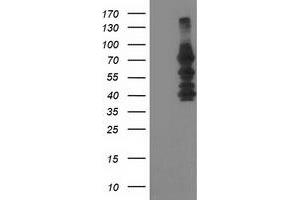 Western Blotting (WB) image for anti-Katanin P80 (WD Repeat Containing) Subunit B 1 (KATNB1) antibody (ABIN1498991) (KATNB1 抗体)