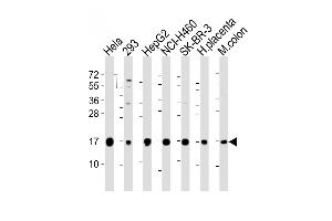 Western Blotting (WB) image for anti-Interferon-Induced Transmembrane Protein 3 (IFITM3) (AA 1-30), (N-Term) antibody (ABIN387989)