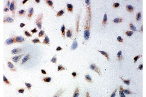 Anti-Prohibitin antibody, ICC ICC: HELA Cell (Prohibitin 抗体  (C-Term))