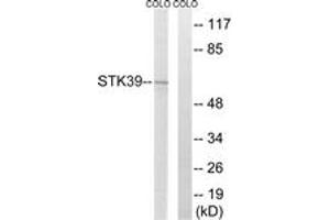 Western blot analysis of extracts from COLO205 cells, using STK39 Antibody. (STK39 抗体  (AA 351-400))