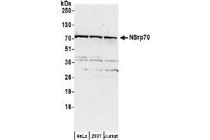 anti-Nuclear Speckle Splicing Regulatory Protein 1 (NSRP1) (AA 508-558) antibody