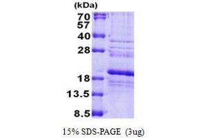 SDS-PAGE (SDS) image for Ribosomal Protein S24 (RPS24) (AA 1-130) protein (His tag) (ABIN6387241)