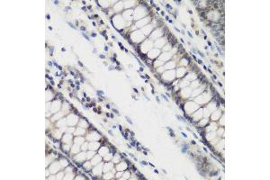 Immunohistochemistry of paraffin-embedded human colon using DHODH antibody at dilution of 1:200 (40x lens). (DHODH 抗体)