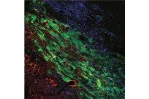 Immunohistochemistry (IHC) image for anti-Potassium Intermediate/small Conductance Calcium-Activated Channel, Subfamily N, Member 4 (KCNN4) (Extracellular) antibody (ABIN7044556)