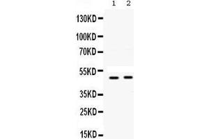 Western blot analysis of SFRP4 expression in A549 whole cell lysates (lane 1) and SW620 whole cell lysates (lane 2). (SFRP4 抗体  (AA 22-303))