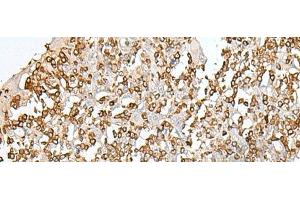 Immunohistochemistry of paraffin-embedded Human tonsil tissue using SEPT1 Polyclonal Antibody at dilution of 1:50(x200) (Septin 1 抗体)
