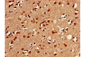 Immunohistochemistry (IHC) image for anti-Forkhead Box C2 (MFH-1, Mesenchyme Forkhead 1) (FOXC2) (AA 24-294) antibody (ABIN7153026)