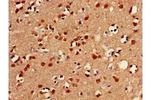 Immunohistochemistry of paraffin-embedded human brain tissue using ABIN7153026 at dilution of 1:100 (FOXC2 抗体  (AA 24-294))