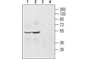 Western blot analysis of mouse (lanes 1 and 3) and rat (lanes 2 and 4) brain lysates: - 1, 2. (ADRA2A 抗体  (Extracellular, N-Term))