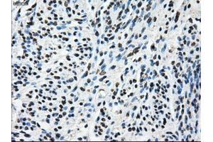 Immunohistochemical staining of paraffin-embedded Ovary tissue using anti-TTLL12mouse monoclonal antibody. (TTLL12 抗体)
