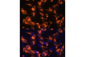 Immunofluorescence analysis of C6 cells using Somatostatin Receptor 2 (SSTR2) Polyclonal Antibody (ABIN7270493) at dilution of 1:100 (40x lens). (SSTR2 抗体  (C-Term))