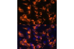Immunofluorescence analysis of C6 cells using Somatostatin Receptor 2 (SSTR2) Polyclonal Antibody (ABIN7270493) at dilution of 1:100 (40x lens). (SSTR2 抗体  (C-Term))