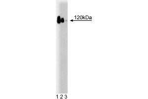 Western blot analysis of E-Cadherin on A431 cell lysate. (E-cadherin 抗体  (AA 735-883))