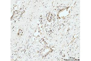 IHC analysis of Nucleostemin/GNL3 using anti-Nucleostemin/GNL3 antibody (ABIN7601778).