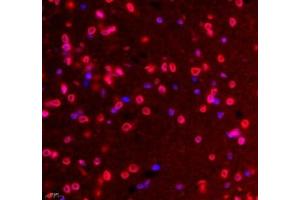 Immunofluorescence of paraffin embedded rat hippocampus using Tuba3a (ABIN7076051) at dilution of 1: 600 (400x lens (Tuba3a 抗体)