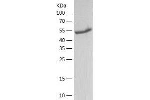 Western Blotting (WB) image for Fat Mass and Obesity-Associated (FTO) (AA 2-502) protein (His-IF2DI Tag) (ABIN7122889)