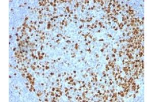 IHC testing of FFPE human tonsil with TOP2A antibody (clone TOP2A/1362). (Topoisomerase II alpha 抗体  (AA 1352-1493))